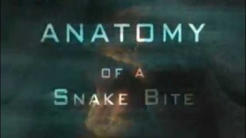 Анатомия змеиного укуса / Anatomy of a Snake Bite (2004)
